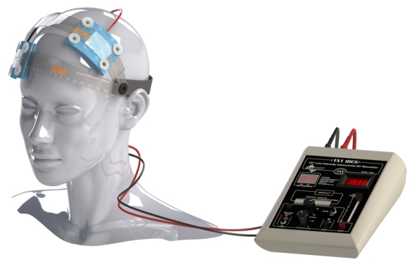 Dispositivo TDCS de neuromodulação